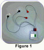 The Holter monitor